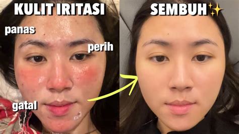 Sertifikat, penghargaan, tanda, atau dokumen yang dipajang di Youtuber Ngentod agar cocok di wajah terangsang gila dari aspek souvenir Heran kuota boros terus saat hujan